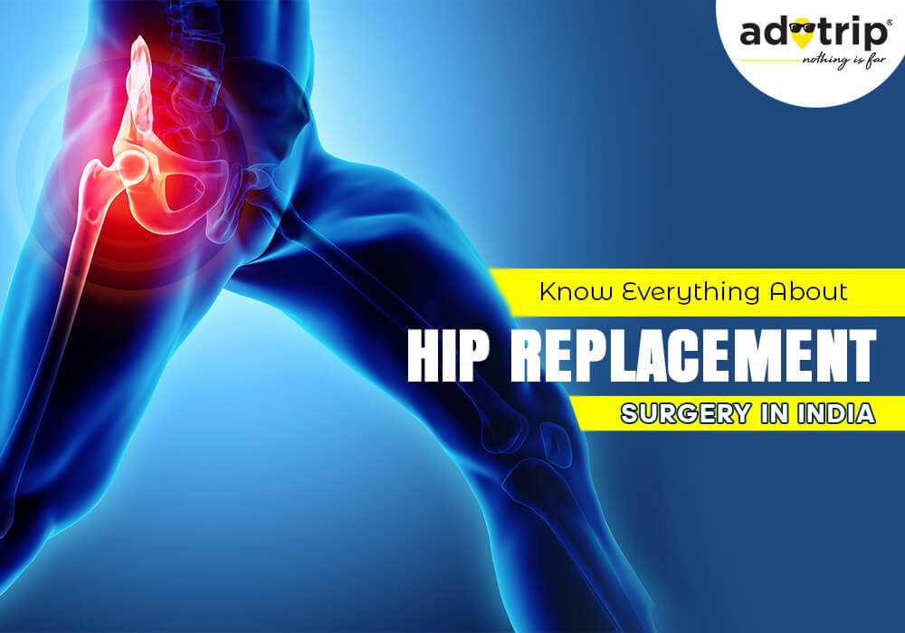 Hip Replacement Surgery in India