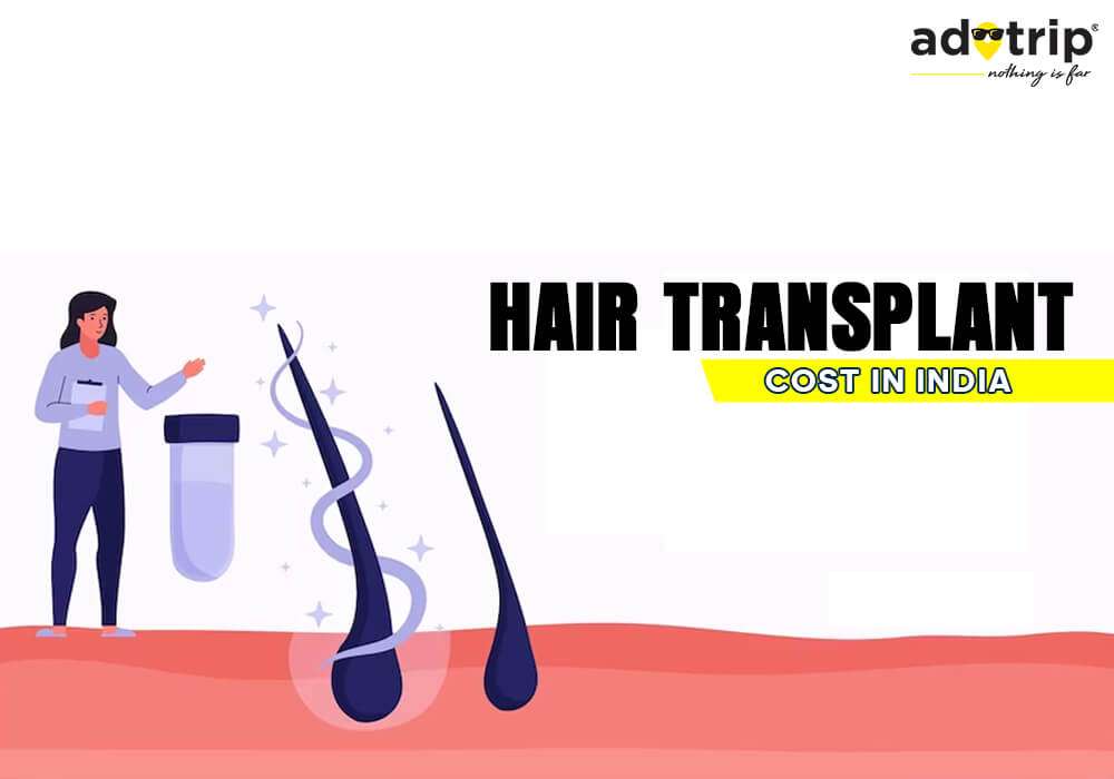 hair transplant cost in india