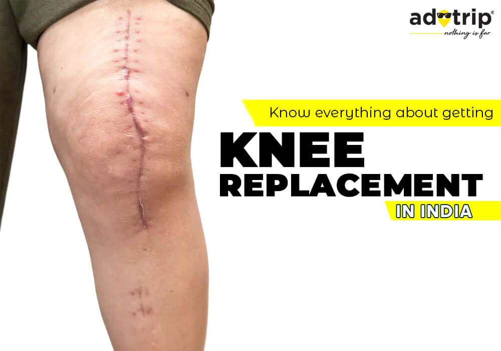 knee replacement surgery in india