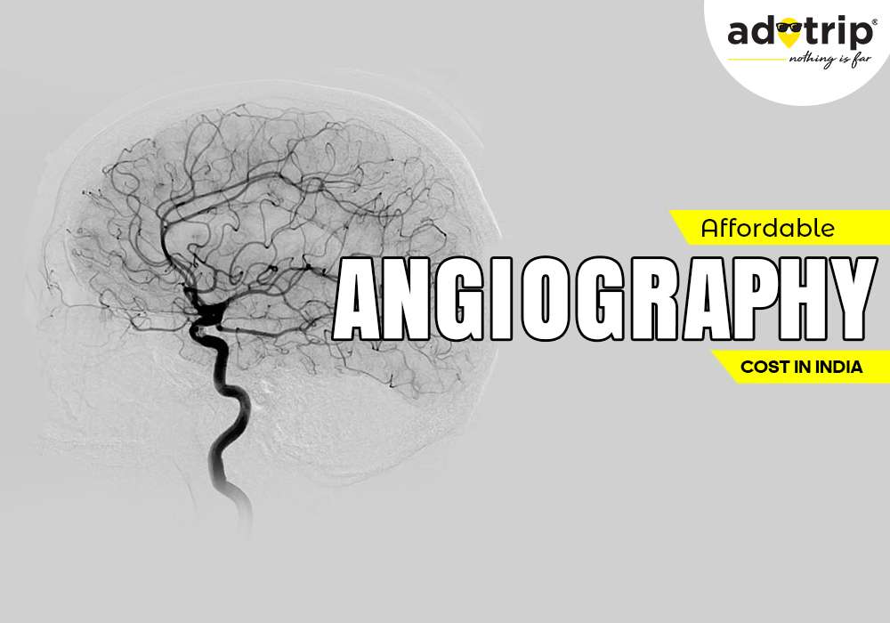 Angiography Cost in India