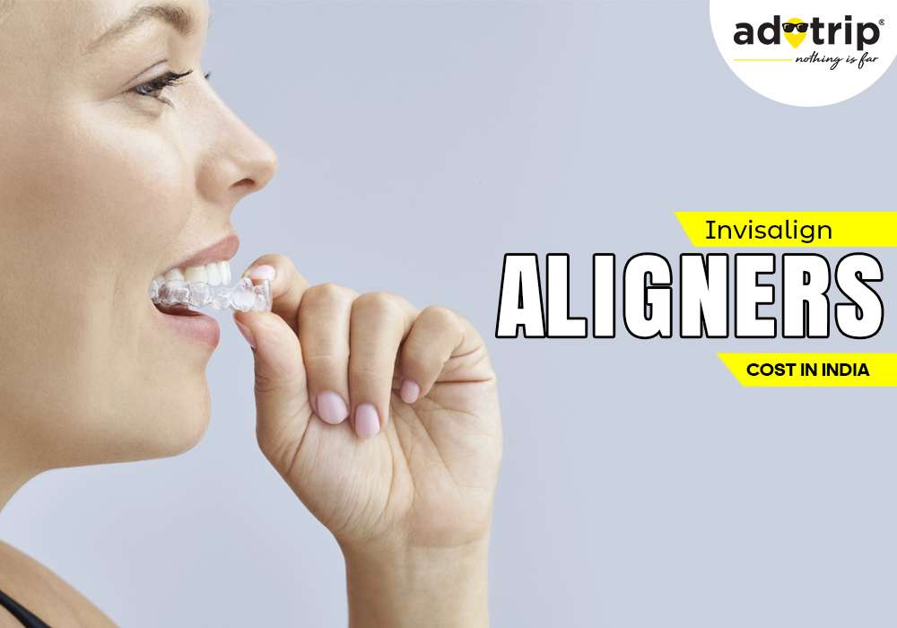Invisalign Aligners Costs in India