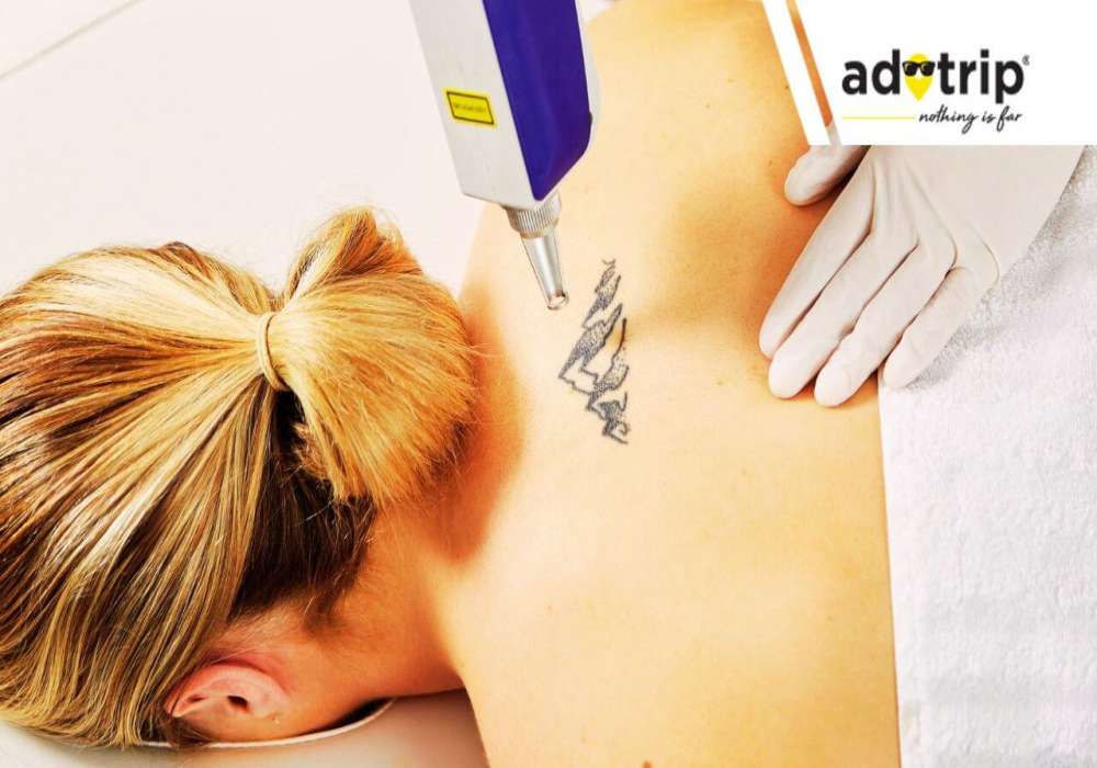 1 Tattoo Removal Machine  Free Training  Lifetime Support